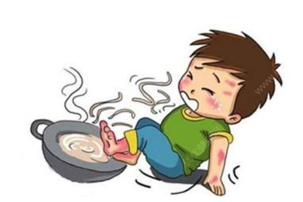 4岁男孩一屁股坐进开水桶，全身65%烫伤，烫伤急救处理方法(1)