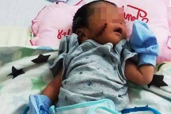 越南男婴被活埋，脸上有4厘米长的伤口(1)