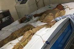 美达股份回应24岁员工遇工伤事故：垫付全部医药费[多图]