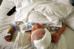 4岁娃被邻居大狗咬掉头皮，亲属：跑4家医院都不收[多图]