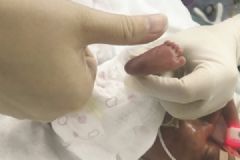 南京“巴掌宝宝”出院，超早产儿出生时体重仅1.1斤[多图]